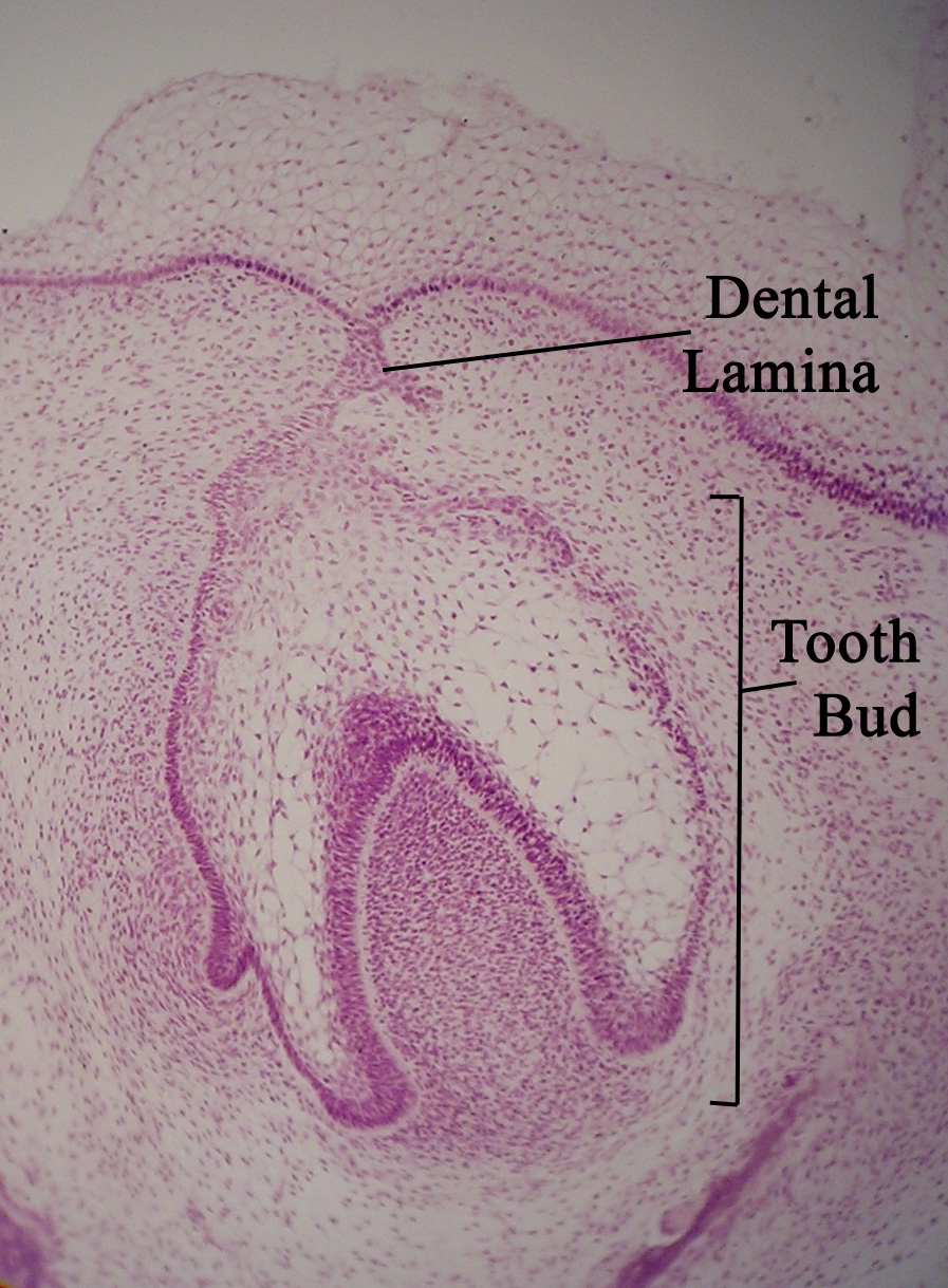 Dentallamina11-17-05